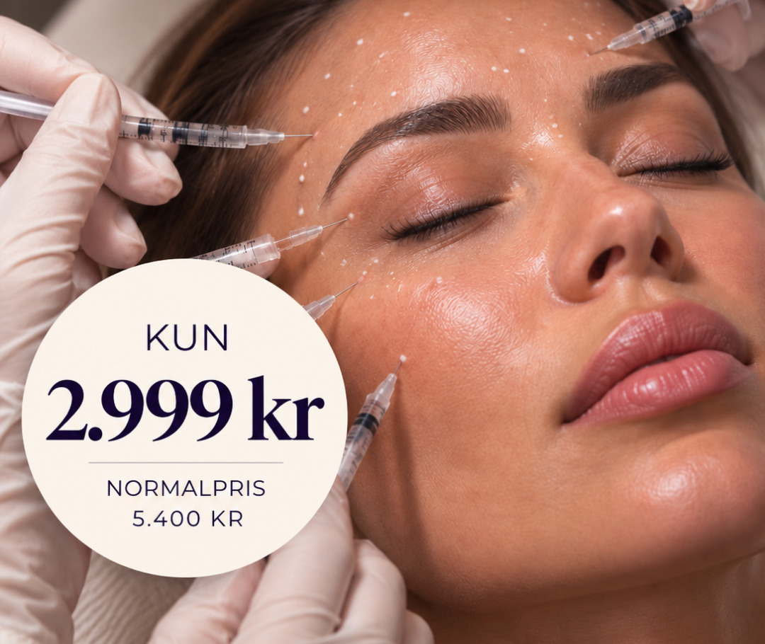 Rynkebehandling, hele ansigtet. Kun 2.999 kr, normalpris 5.400 kr.